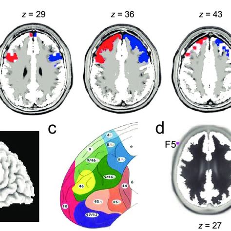 Dorsolateral prefrontal cortex regions of interest. The axial slices in ...