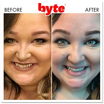 Byte Before & After Photos: Pics of Real Customer Results