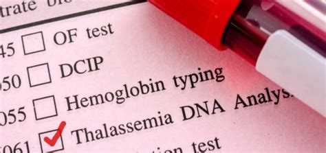 Beta Thalassemia Treatment Cost in India from Best Doctor