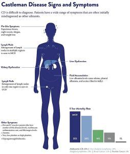 Castleman Disease - Ask Hematologist | Understand Hematology