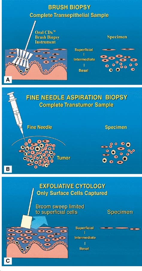 Figure 3 from Improving detection of precancerous and cancerous oral ...