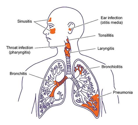 Pin en Respiratory education