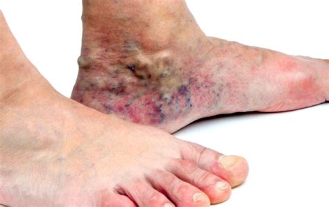 What Causes Skin Discoloration? | USA Vein Clinics