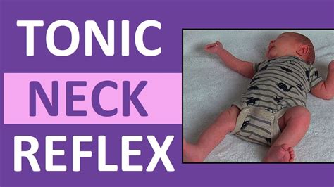 Tonic Neck Reflex in Infant Newborn | Pediatric Nursing Newborn Assessment - YouTube