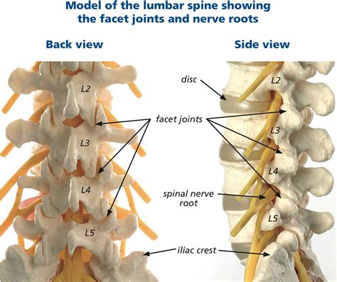 Lumbar facet syndrome causes, symptoms, diagnosis, treatment & prognosis