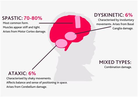 Types of cerebral palsy - Cerebral Palsy Cymru