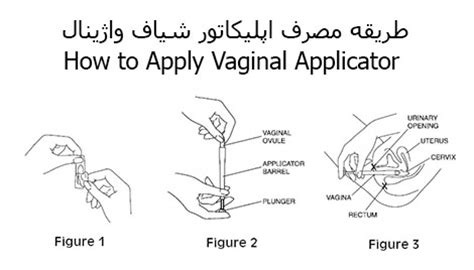 Vaginal Suppository Applicator - شرکت سینا کالای شمس