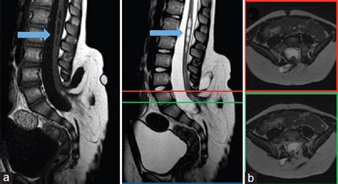 Surgical Neurology International