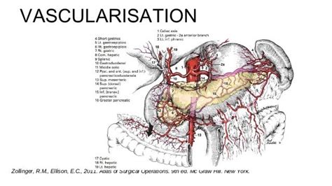 Gastric Perforation