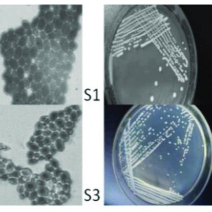 Cell morphology and colony morphology. Note: the magnification of the... | Download Scientific ...