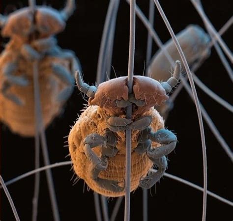 some strange looking bugs hanging from the side of a pole