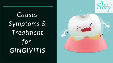 What is Gingivitis - Causes, Symptoms, Treatment