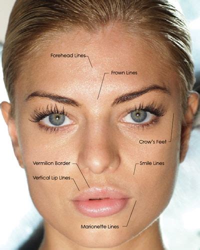 Long Term Side Effects Of Botox And Fillers