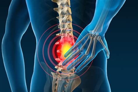 The Effects Of Spinal Decompression For Lumbar Disc Herniation - El ...