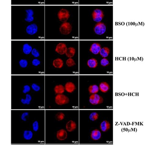 (A) K562 cells were treated as indicated for different time periods and ...