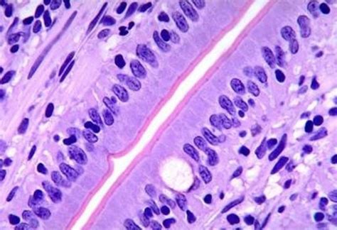 Non-Ciliated Simple Columnar Epithelium | Tissue types, Exocrine gland ...