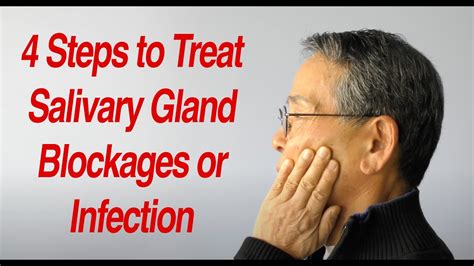 4 Steps to Treat Salivary Gland Swelling at Home - YouTube