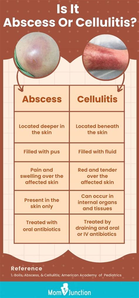 Cellulitis Abscess