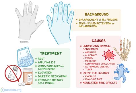 Swollen Fingers: What Are They, Causes, Treatment | Osmosis