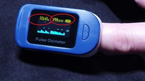 Should everyone buy a home pulse oximeter during coronavirus (COVID-19 ...