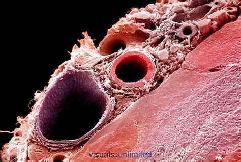 A distributing artery,right, and a medium-sized vein,left, surrounded ...