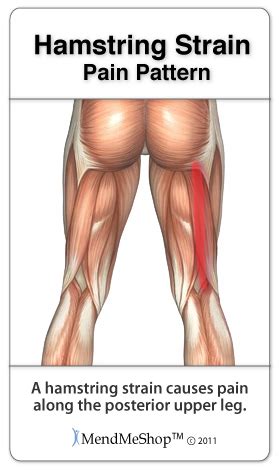 Symptoms of Hamstring Strain