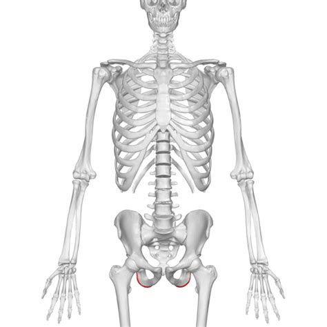 Ischial Bursitis - Physiopedia