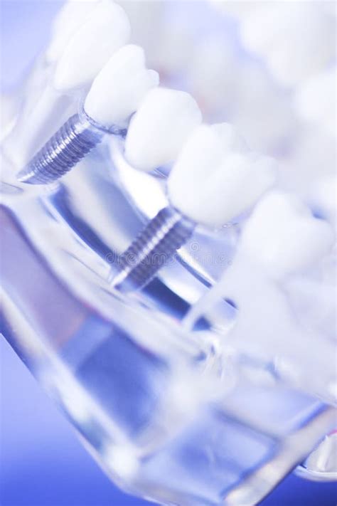 Dental teeth mouth model stock image. Image of dentures - 101133529