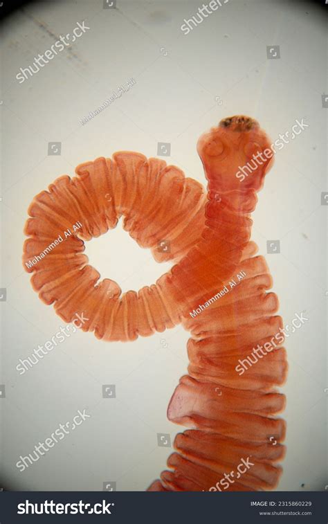 Trichuris Trichina Royalty-Free Images, Stock Photos & Pictures | Shutterstock