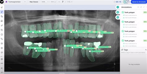 AI In Diagnosis: How AI Is Transforming Medical Diagnosis