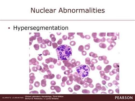 Chapter 21 Non-malignant disorders of Granulocytes and Monocytes - YouTube