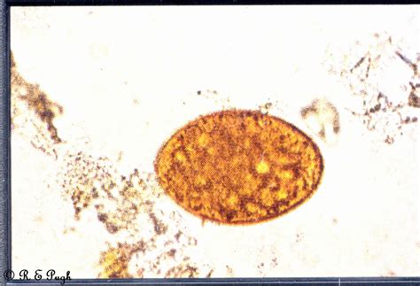 Diphyllobothrium Latum Larvae