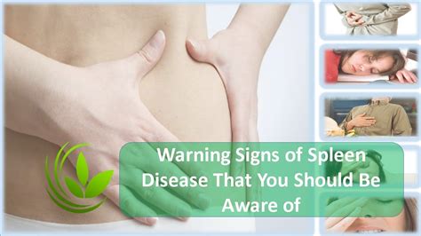 Warning Signs of Spleen Disease That You Should Be Aware of - YouTube