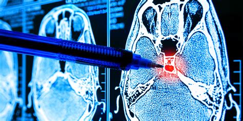 When To Seek A Brain MRI | American Health Imaging