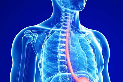 Schatzki’s ring causes restriction of esophagus | UCLA Health