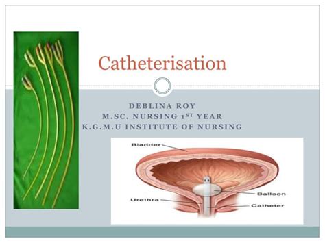 Suprapubic cystostomy