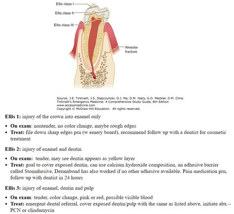 Ellis Class 3 Fracture Treatment Images – FRACTURE