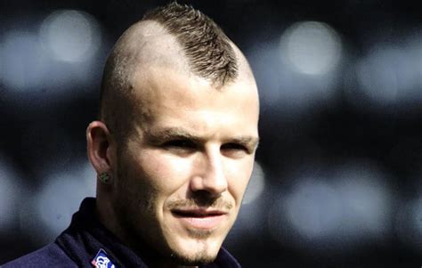 Did David Beckham Get A Hair Transplant?