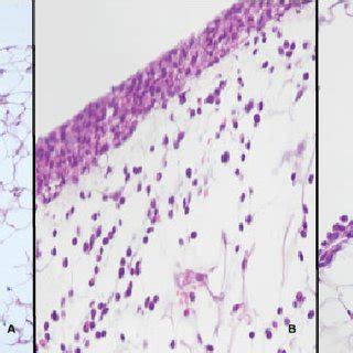 Visceral Peritoneum Histology