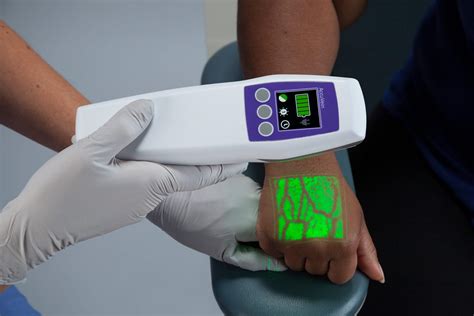 Clearing the Path: The Advantages of Vein Visualization Systems