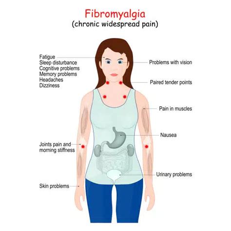 Fibromyalgia Treatment in the Woodlands | CHSR