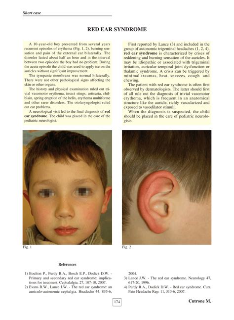 Inner Ear Tumor Symptoms