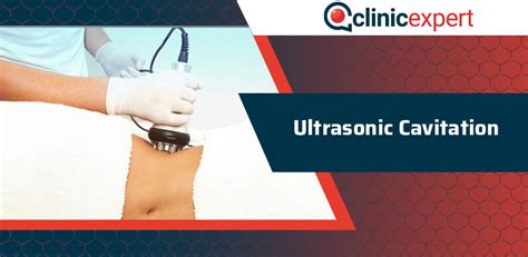 Ultrasonic Cavitation | ClinicExpert