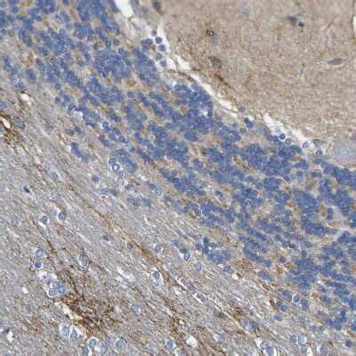 Otoferlin Antibody (NBP1-85233): Novus Biologicals