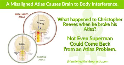 What is The Atlas Bone? | Family Health Chiropractic