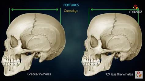 Male x female skull | Medical, Skull, Medical education