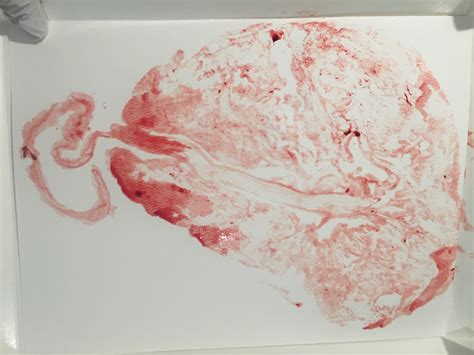 Placenta Prints with Colorized Digital Images - Placenta Encapsulation Services