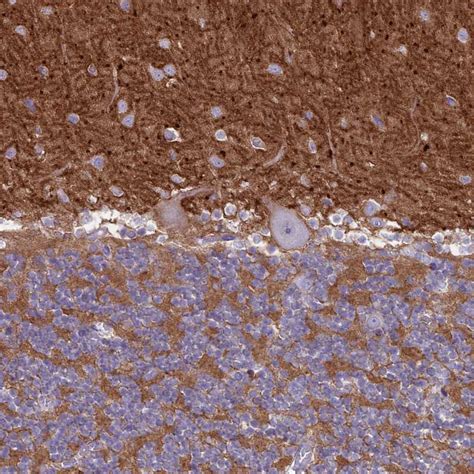 CD56 Antibody (PA5-83479)