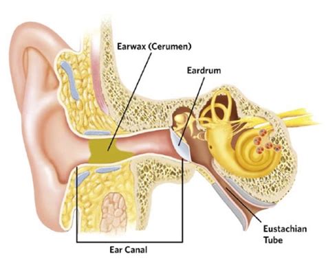 Cerumen, wat is dat? - Hearings BV