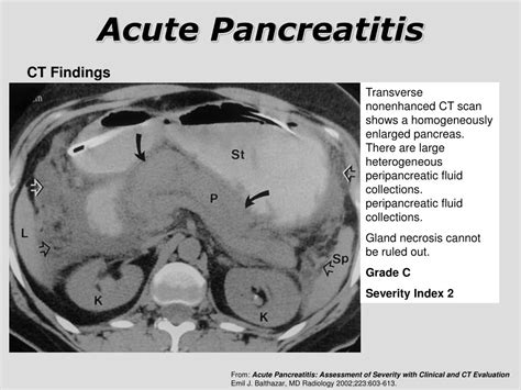 PPT - Pancreatic Diseases PowerPoint Presentation, free download - ID:4491908